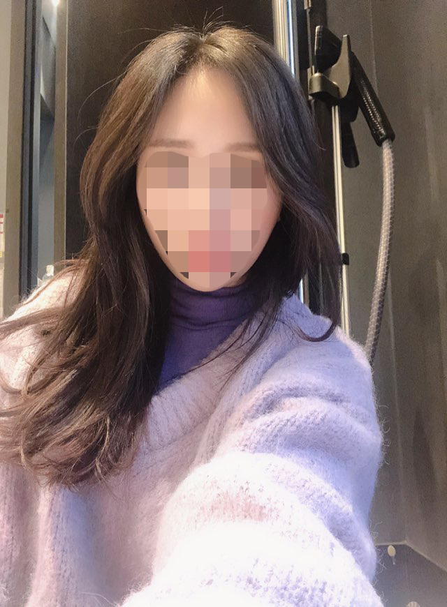 다나에서 헤어라인 절개 두달 됐어요~^^