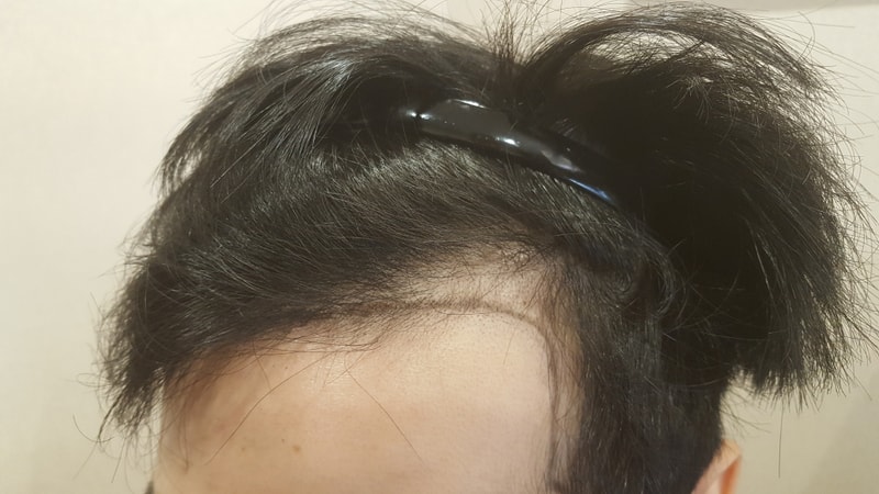 저도곧수술들어갑니다