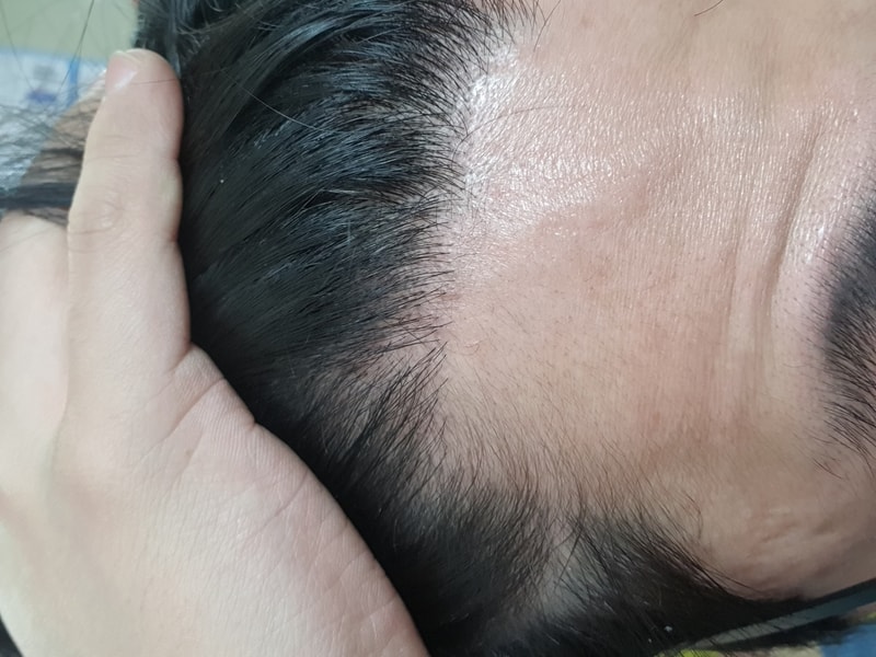 절개2400모 7개월차입니다