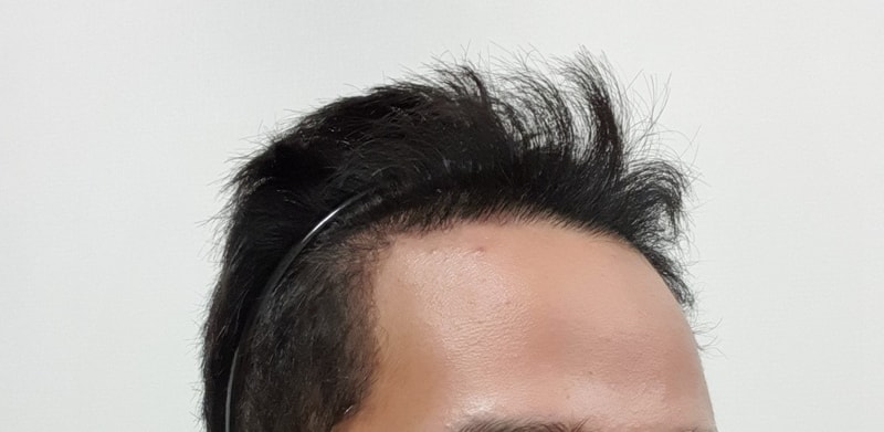995BAE30-1BEA-4850-8DB2-DBABD3E55B2E.jpeg