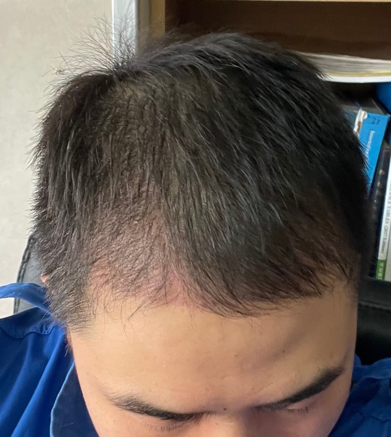 저장용 3개월 돌파~