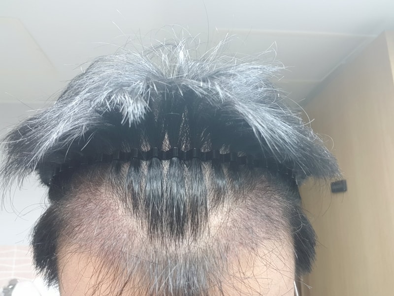 3개월차