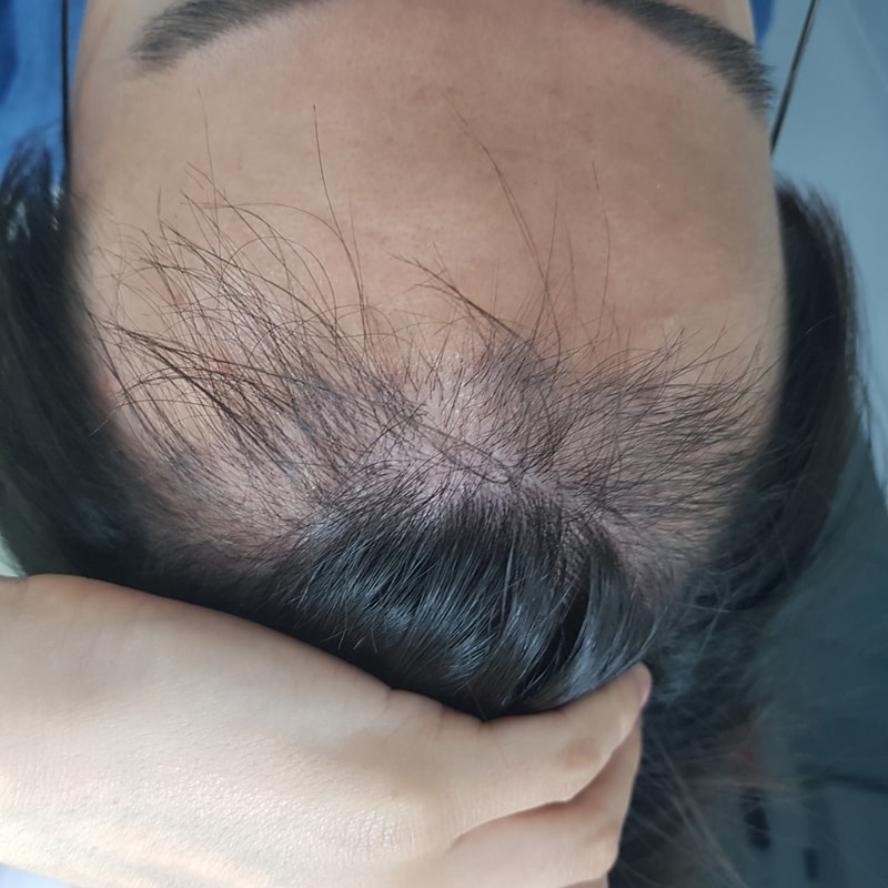 5개월차 후기