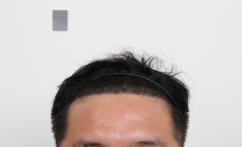 1000036353.jpg