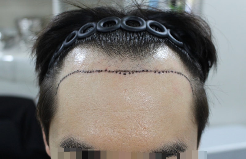 모다올의원 양유군원장님 1년차 후기
