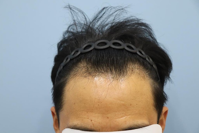 광주압구정모비앙 1년경과 사진