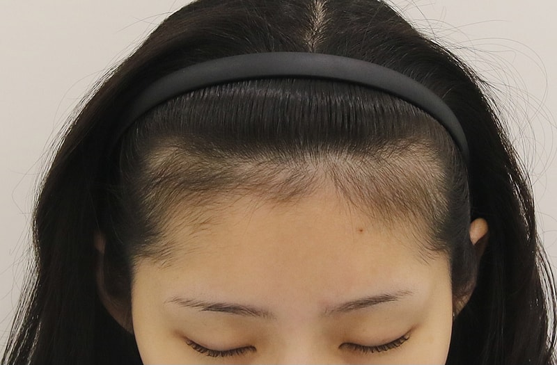 1000030870.jpg
