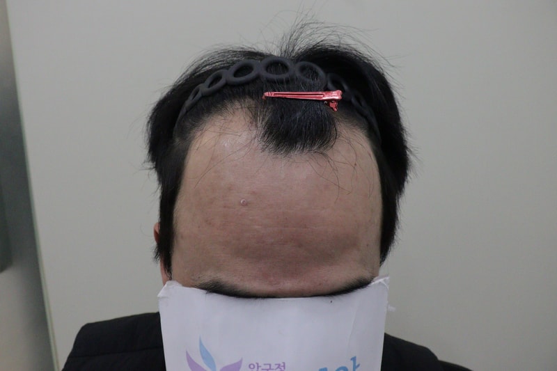 광주압구정모비앙6개월 후기