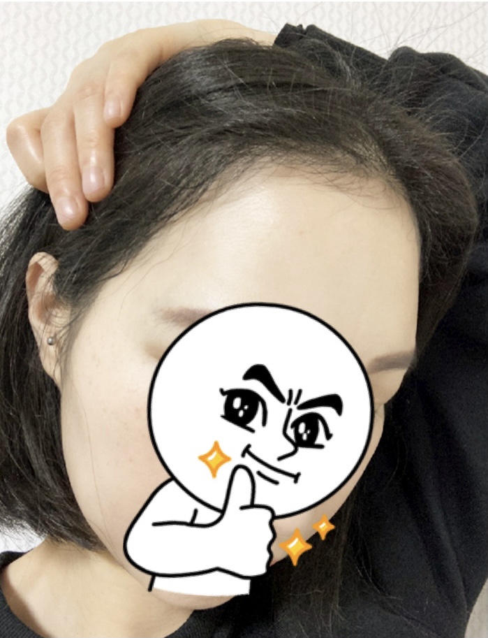 다나에서 수술했어요. 7개월~