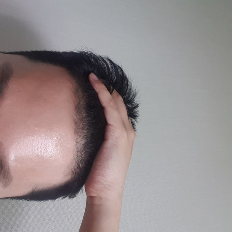 비절개 2805모 약 4개월 + 19일 차입니다!