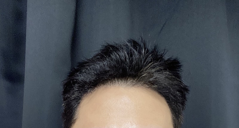 다나 엠자 5개월 경과