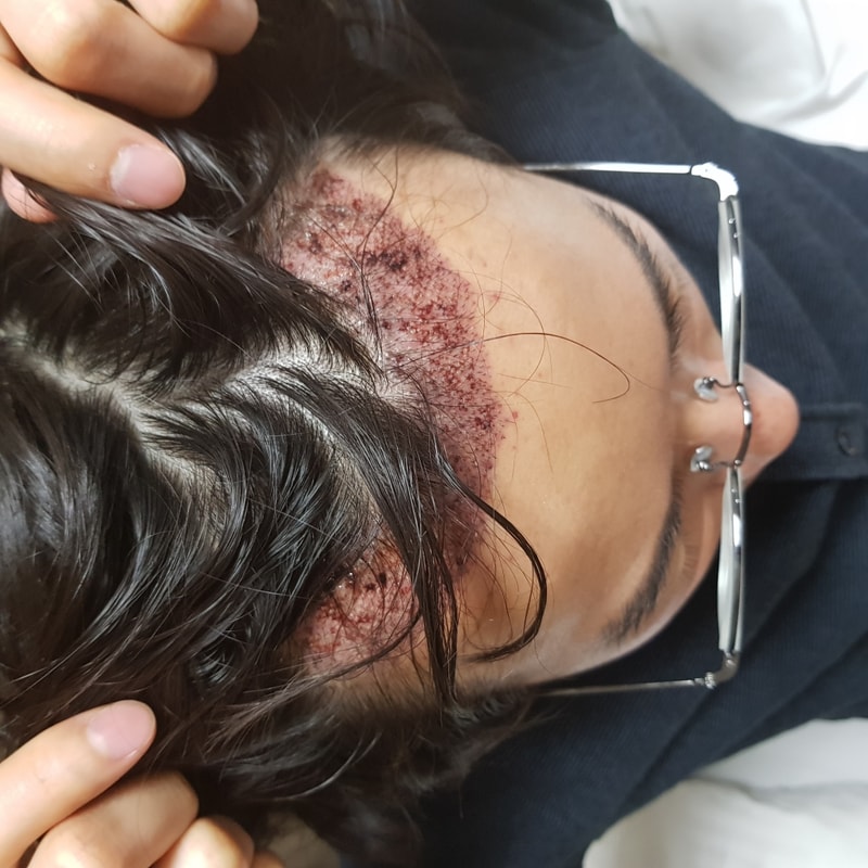 뉴헤어 3일차 후기 올립니다