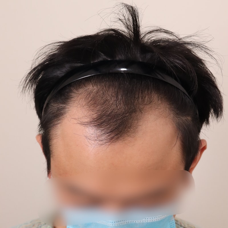 대공사 하고 왔습니다