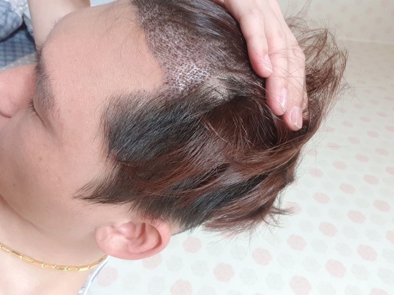 광주광역시 M자 매우고 왔어요