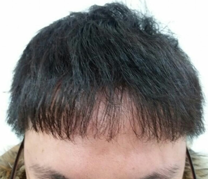 두달차3.jpg