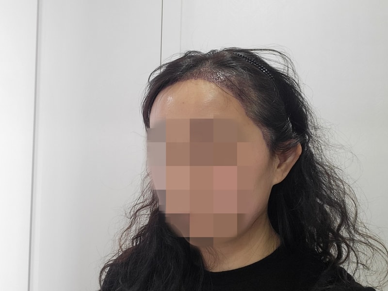 이수진 1일 앞2.jpg
