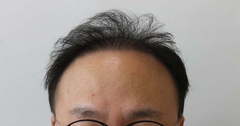 이창준 후.jpg