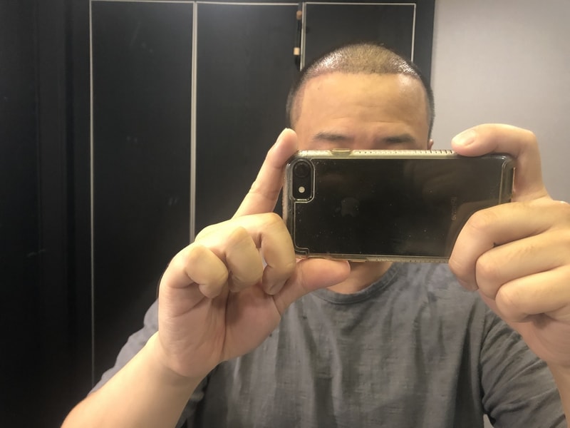 모아트삭발  2주 지문샴푸 했어요