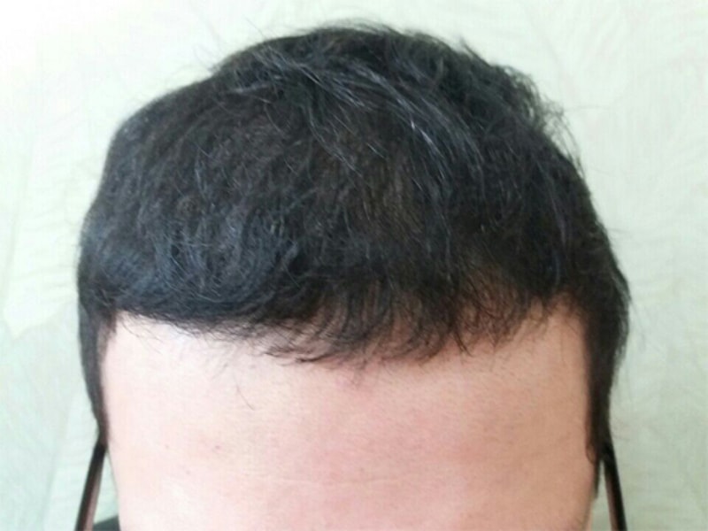 후1.jpg
