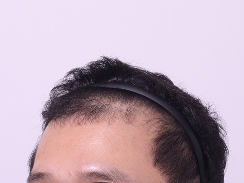 전2.jpg