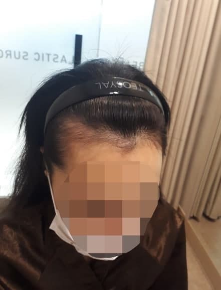 수술전.jpg