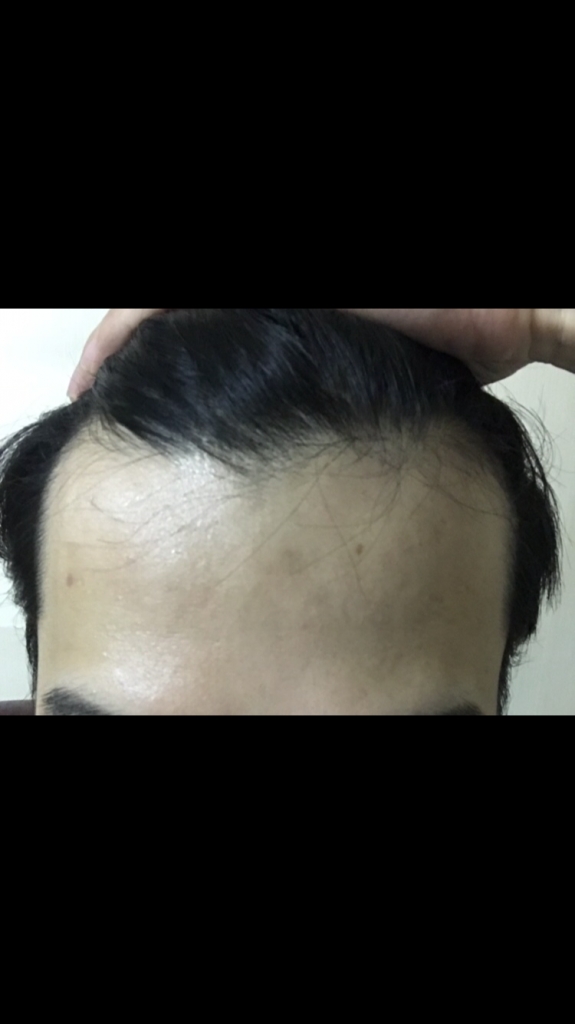 AFCBC48D-44C6-4D7B-9F2B-53F9A6EC1424.png