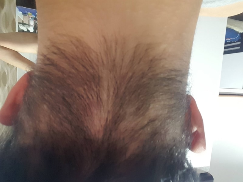 20170304_053523.jpg