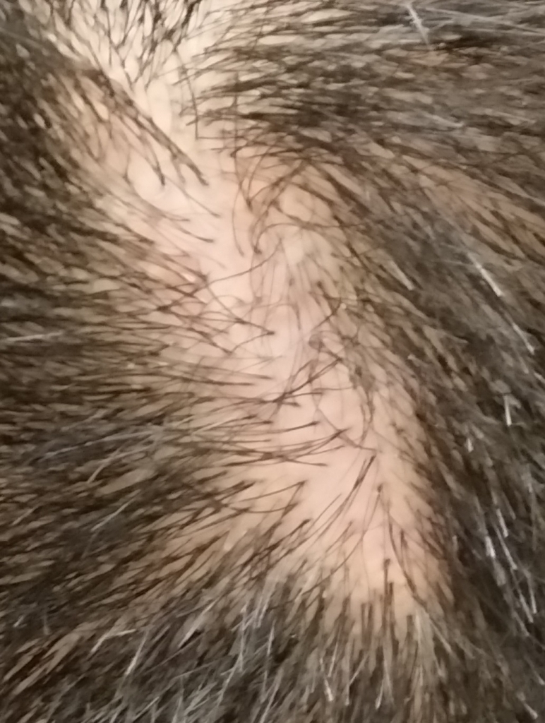 Back wound.jpg