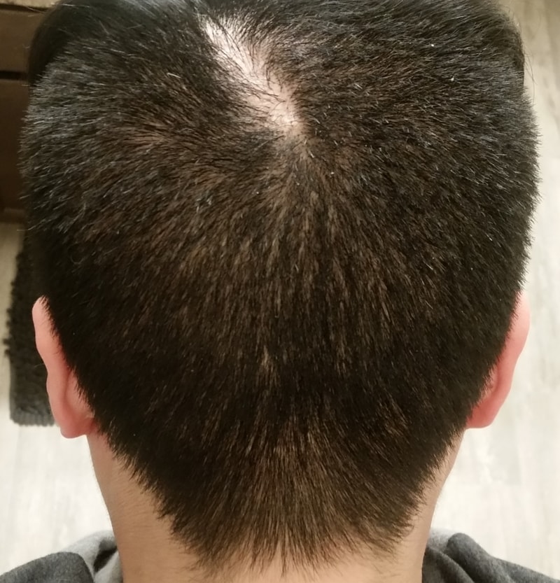Back donor.jpg