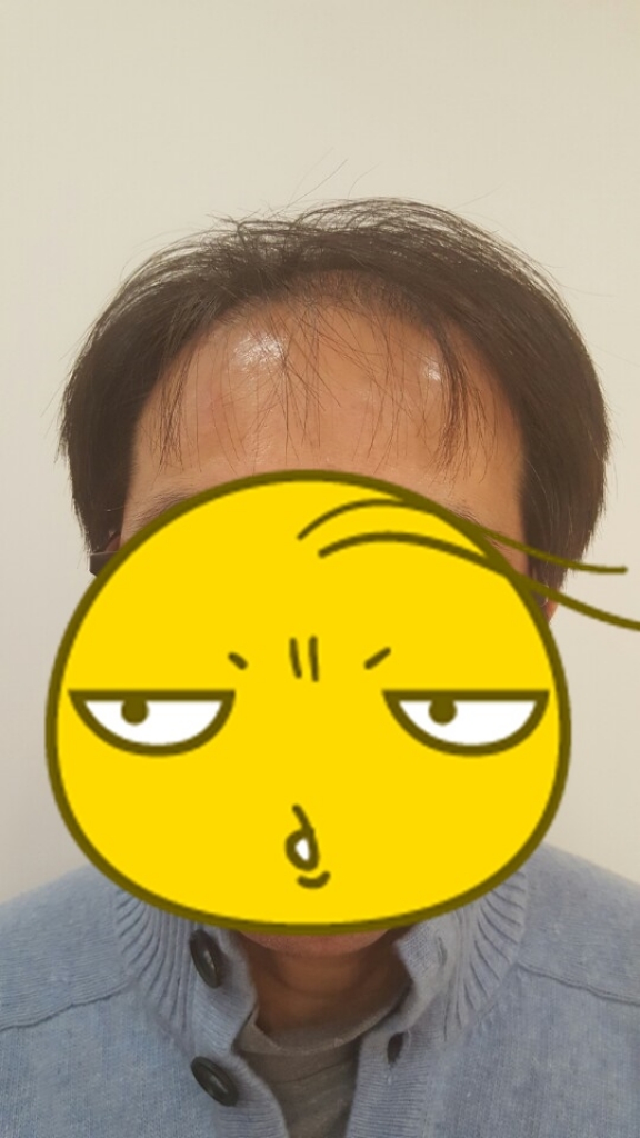 1.JPG