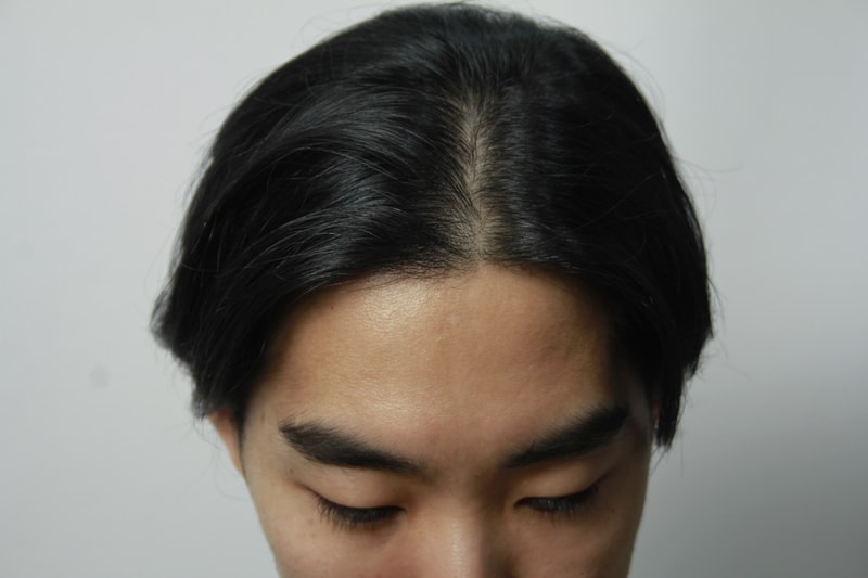 수술전 17.JPG
