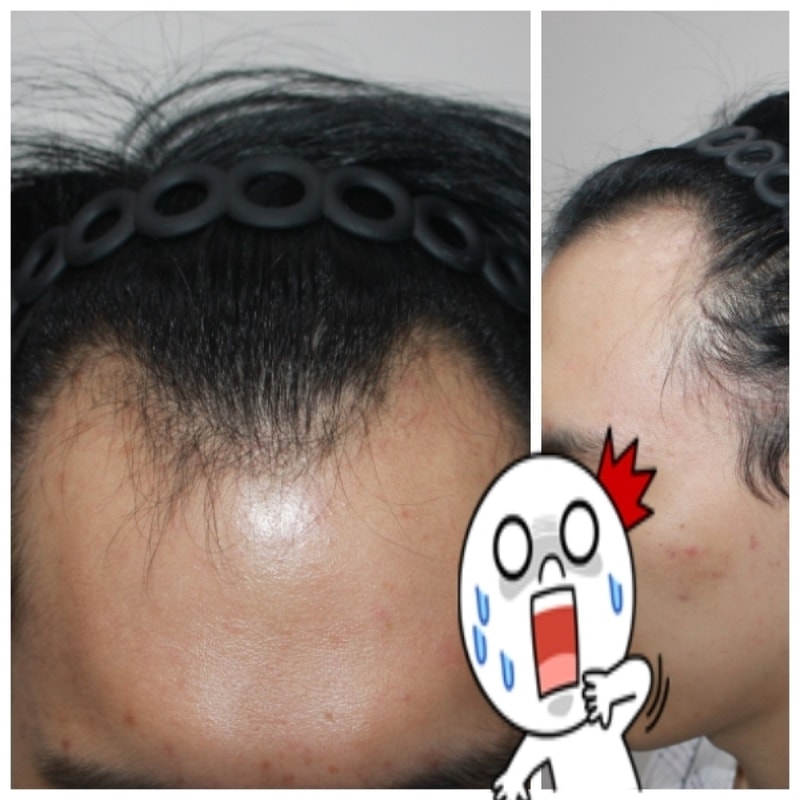 수술전 상태.jpg