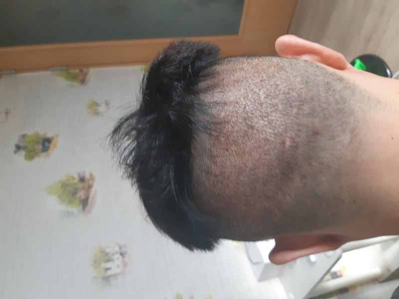 3일차 뒤.jpg