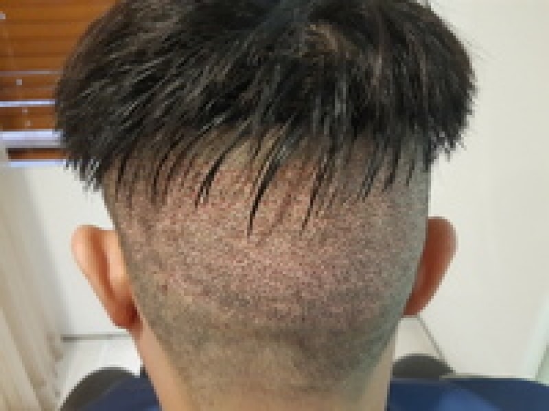 샴푸 후 뒷.png