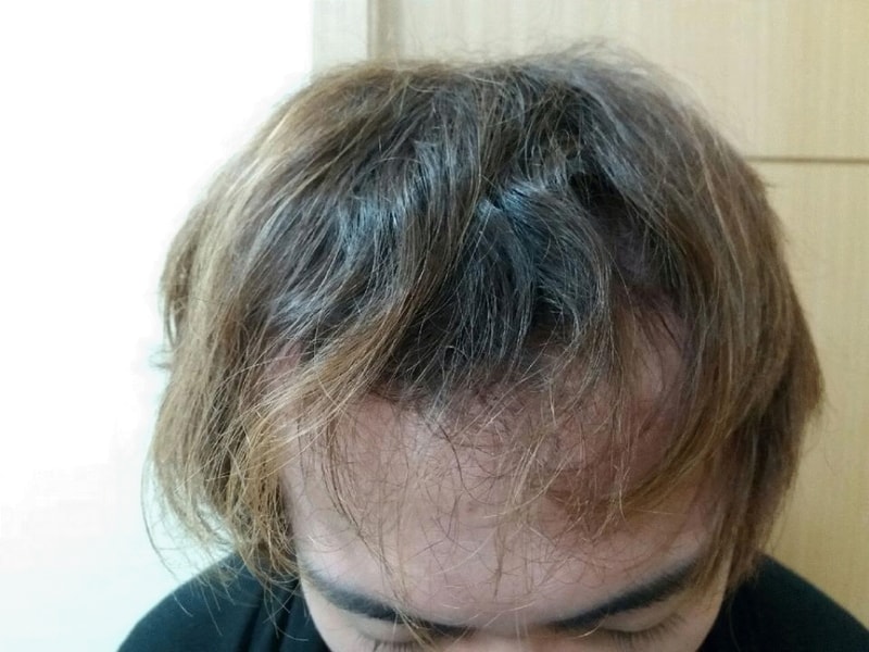 포맷변환_Resized_20161031_102144.gif