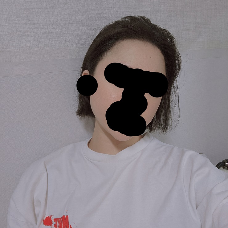 다나 절개 9개월차!