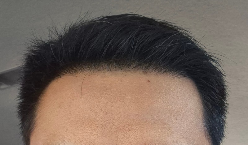 202일후기