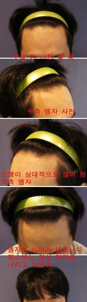 탈1.jpg