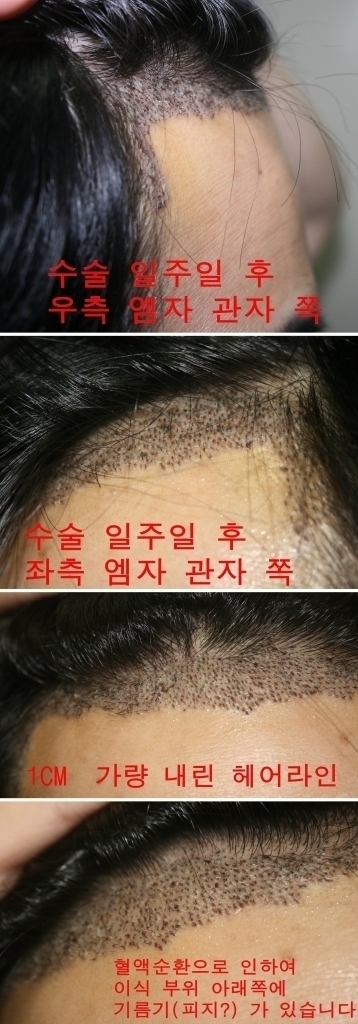 1탈3.jpg