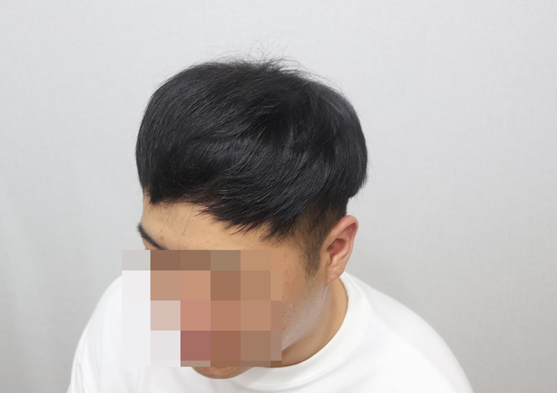 6개월 좌측.JPG