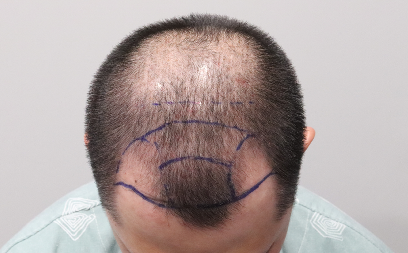 다나  1년6개월 득모졸업입니다