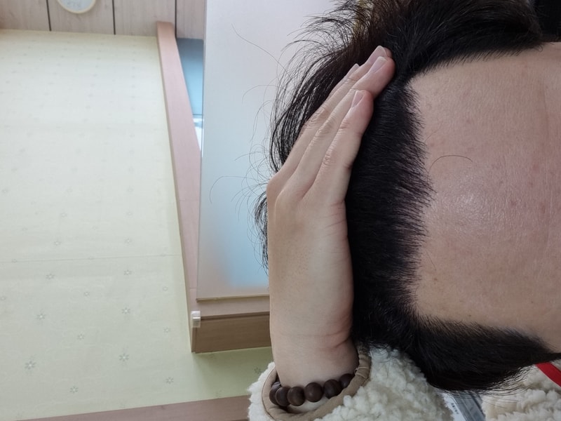 뉴헤어 259일차(8개월 지남)