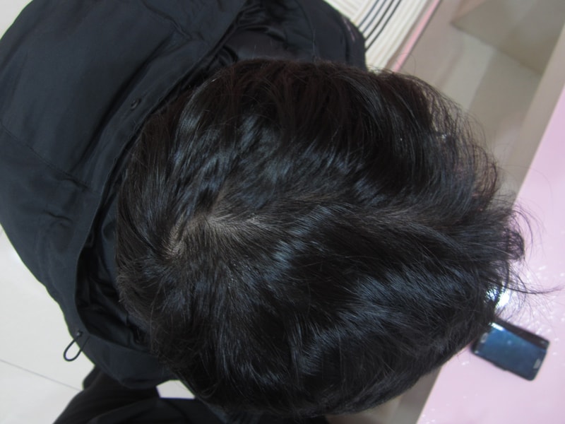 정수리.JPG