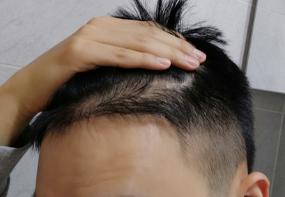 수술후3.PNG