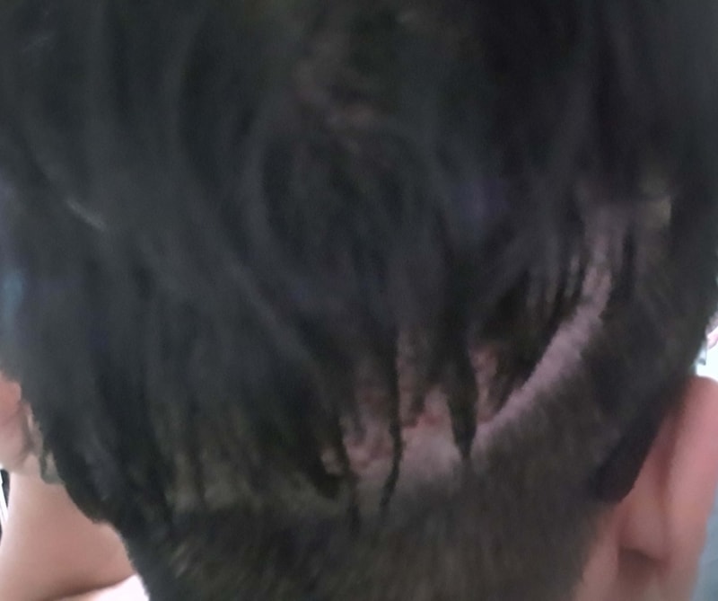 채취 뒷머리.jpg