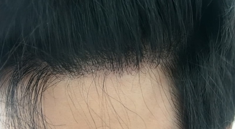 좌측.jpg