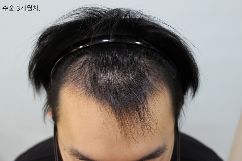 3개월차.jpg