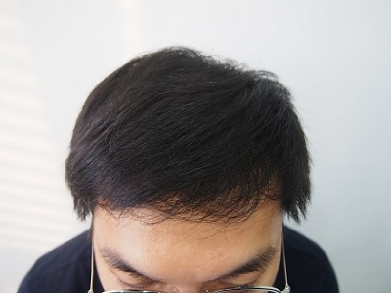 8개월 1.JPG