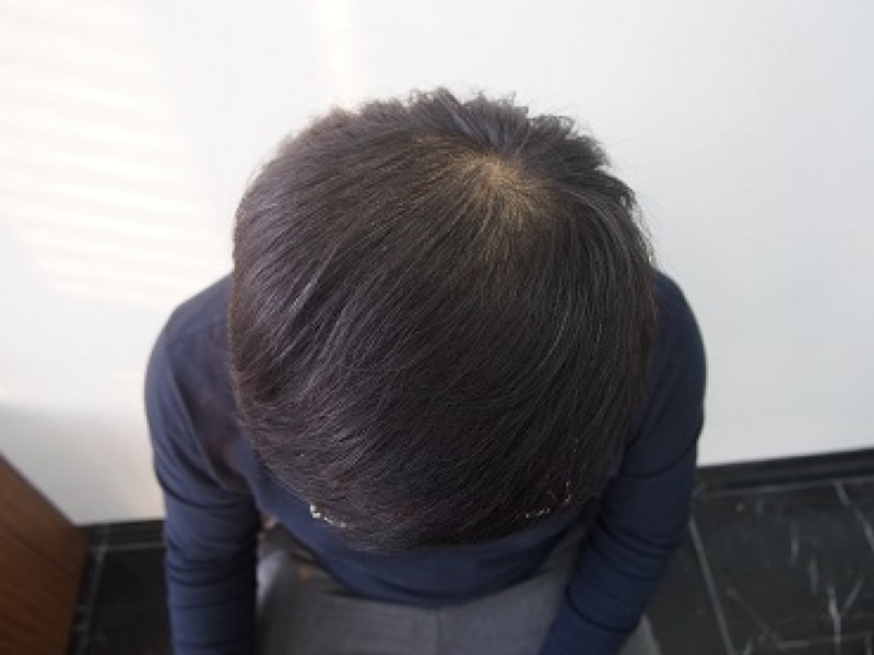 8개월 2.JPG