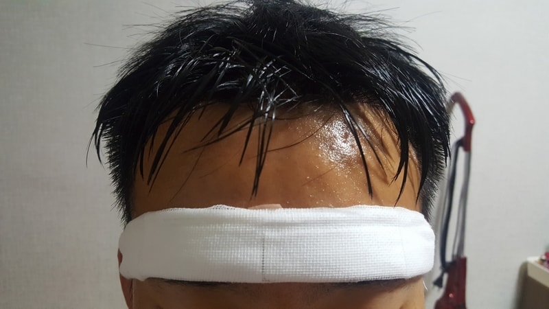 붕대감은모습.jpg